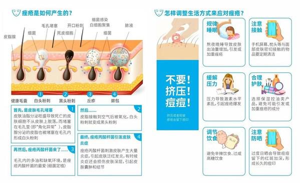 最新瘙痘治疗技术进展与体验分析