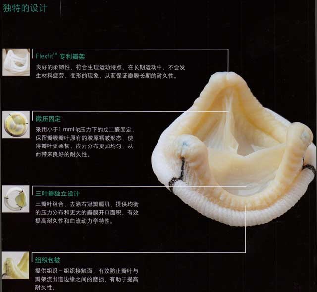 生物瓣最新技术突破与未来展望：材料、应用及挑战