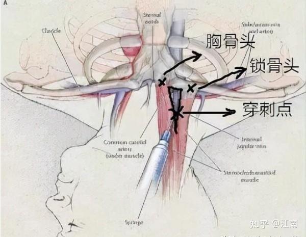 最新锁骨头设计趋势及未来展望：从时尚到功能性创新